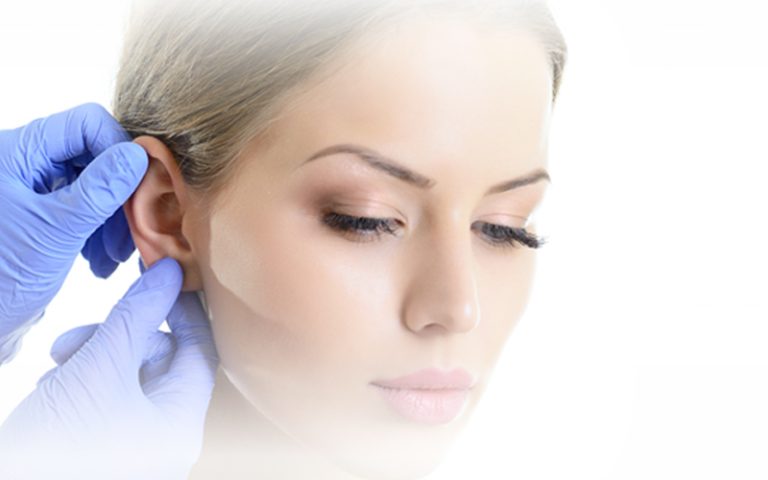 Otoplastica Milano Otoplastica Milano