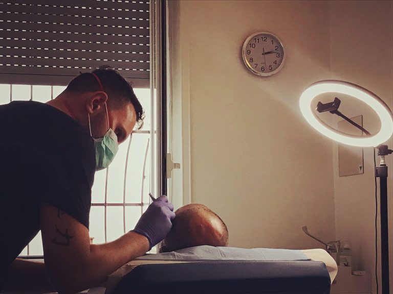 Tricopigmentazione Milano e dintorni