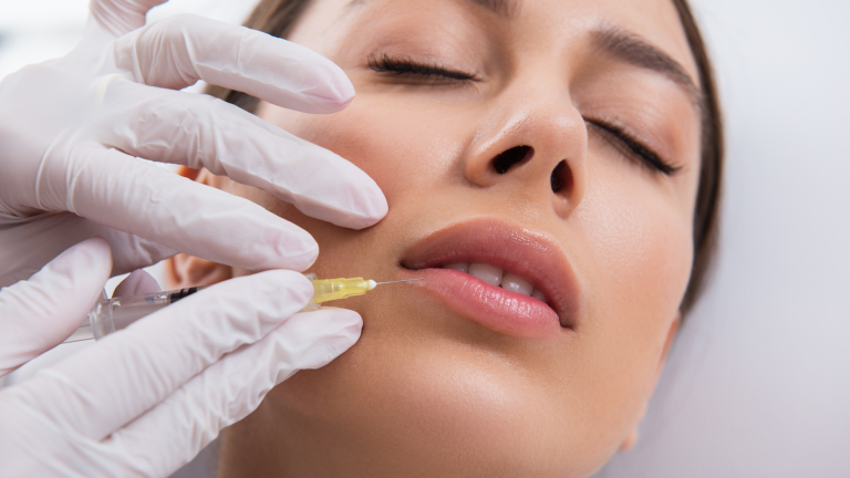 Filler zigomi e labbra a Milano Sud