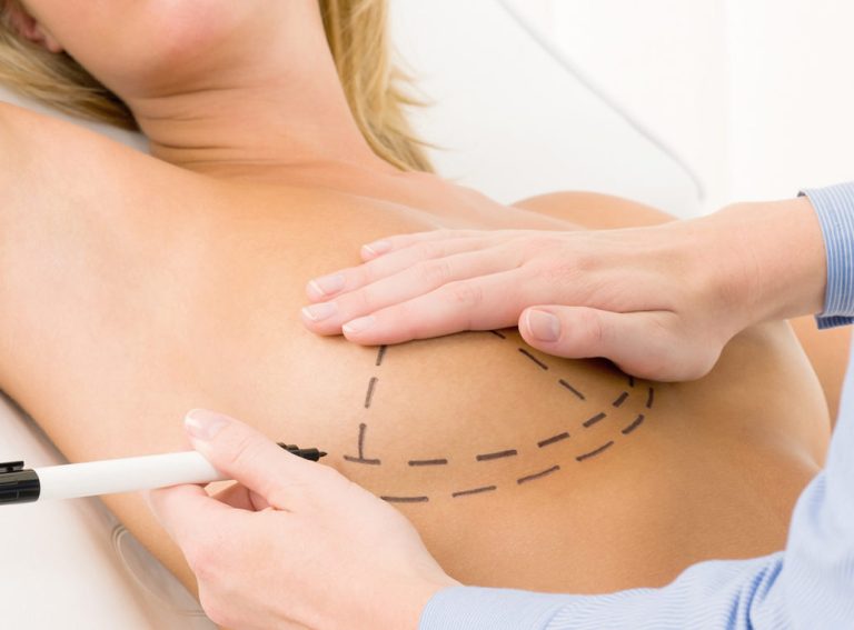 Ridurre i segni dell'età Roma